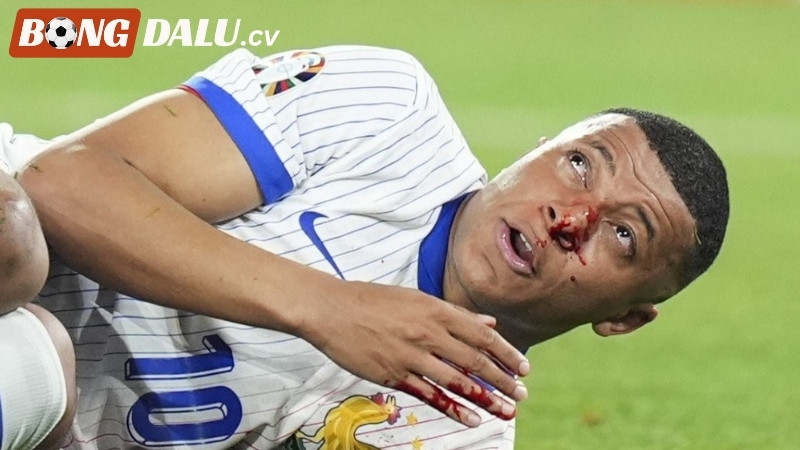 Chấn thương của Kylian Mbappe có ảnh hưởng đến đầu ra bàn thắng của Real Madrid?